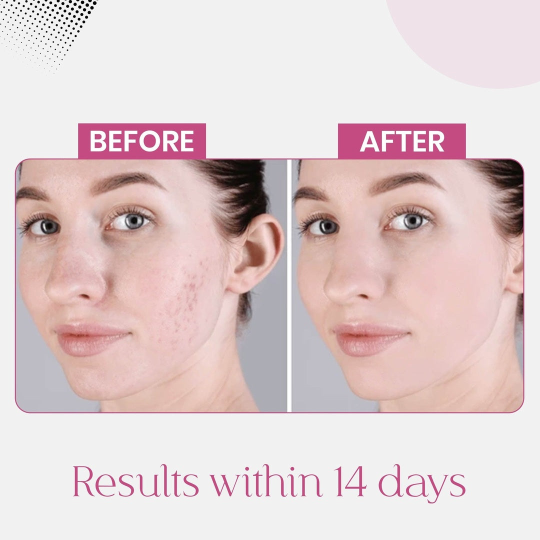 Pigmentation Correction Trio