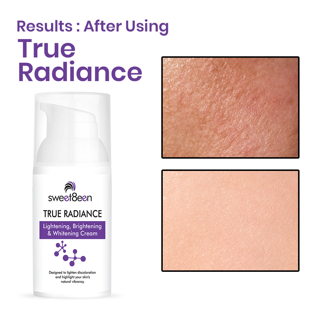 True Radiance Lightening Brightening Whitening Cream - Pack of 2