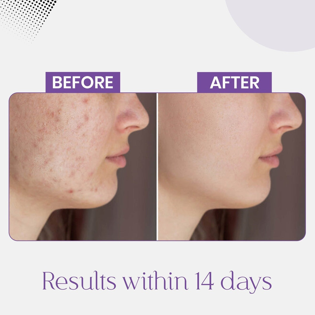 Whitening Pro Bundle