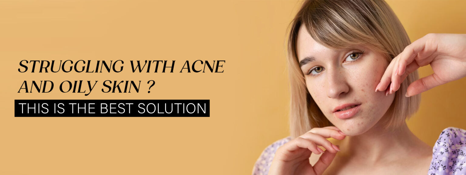 Struggling with Acne and Oily Skin? This Is the Best Solution