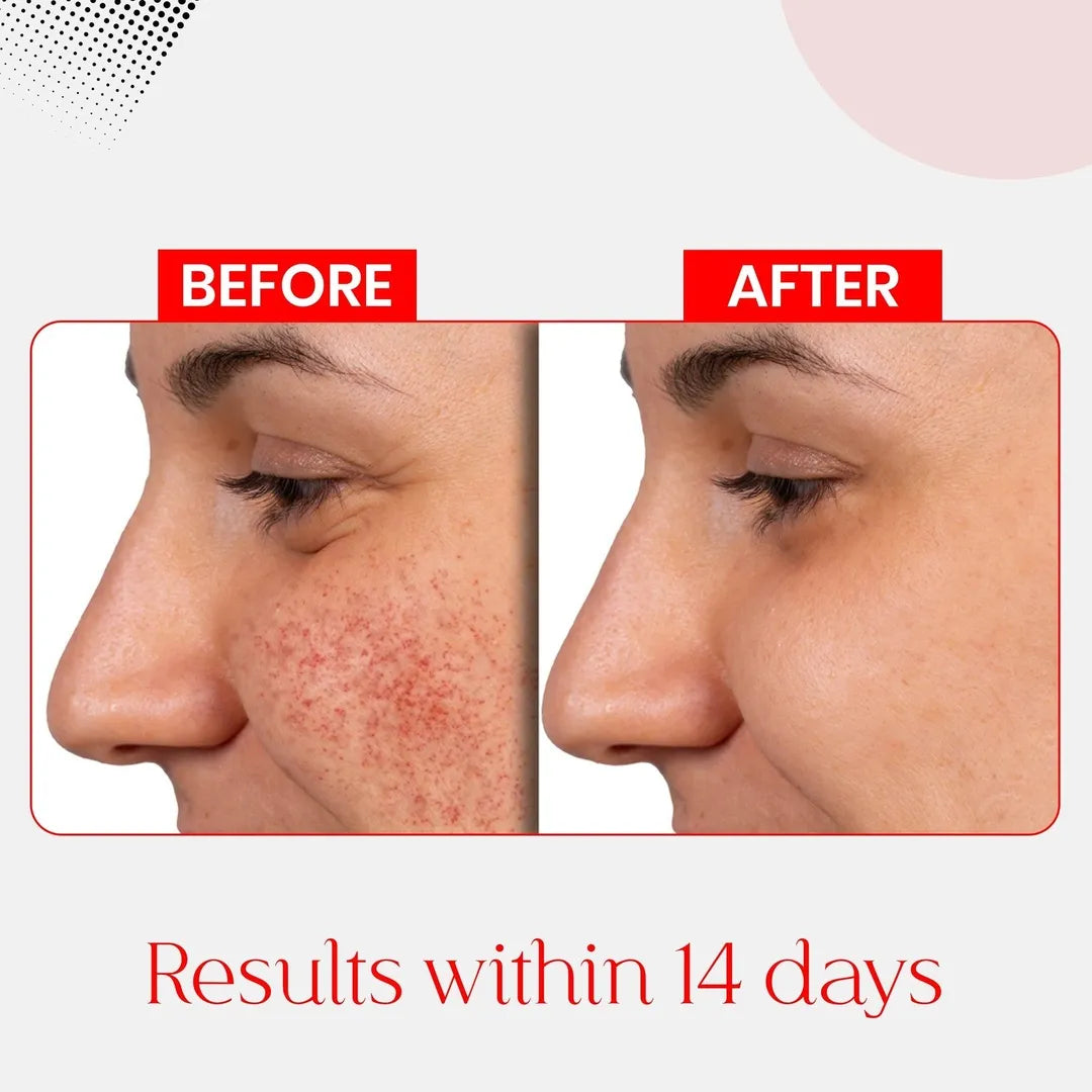 Anti Pigmentation Bundle