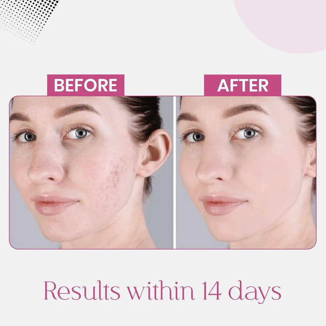 Pigmentation Correction Trio